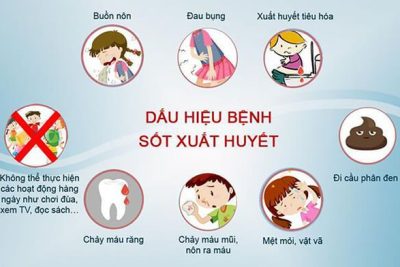 Sốt xuất huyết: Nguyên nhân, triệu chứng, điều trị và cách phòng